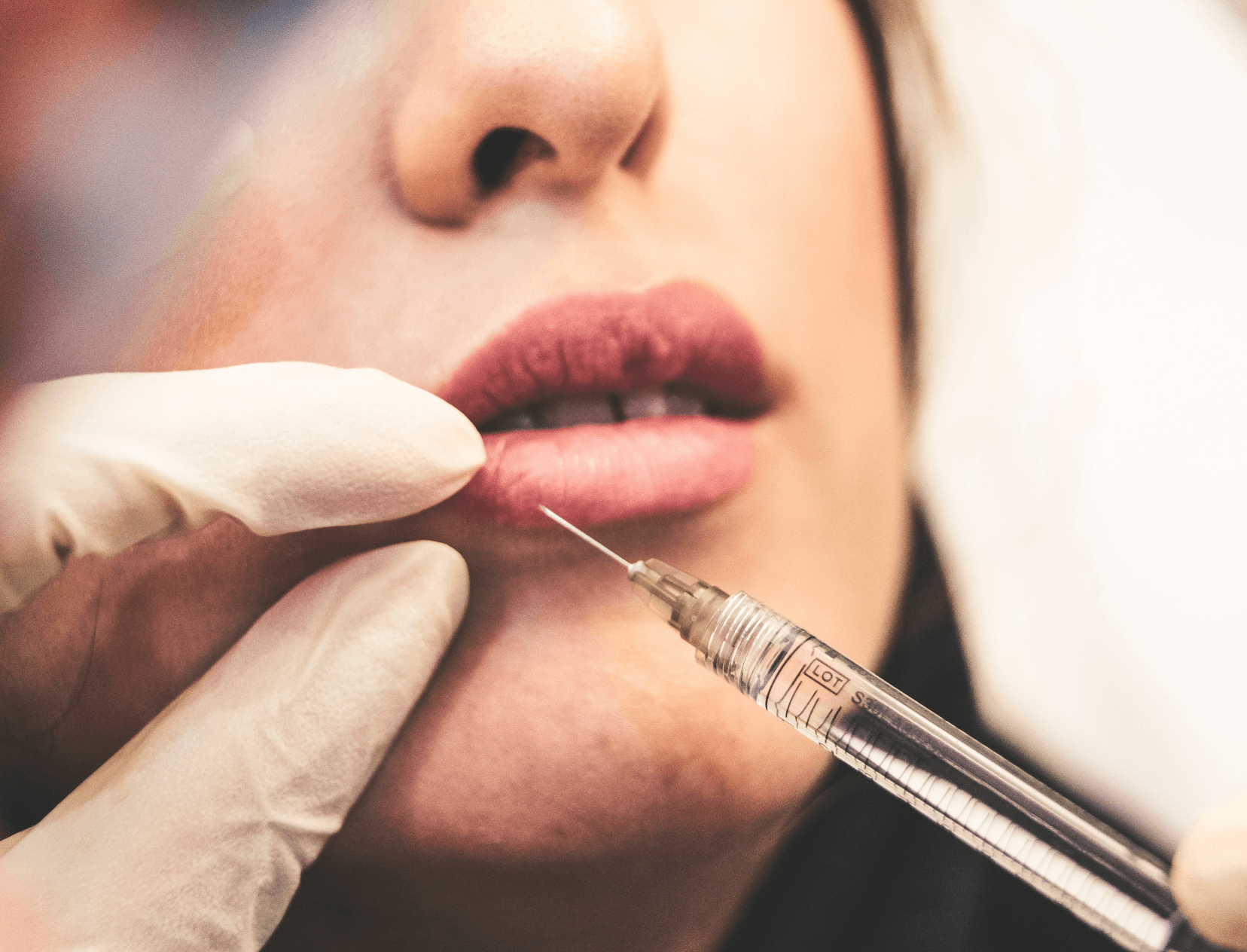 Smooth Forehead, Rough Consequences: Botox Horror Stories That’ll Make You Think Twice Before Getting It